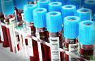 Global Blood Therapeutics Shows More Downside Risk Right Now